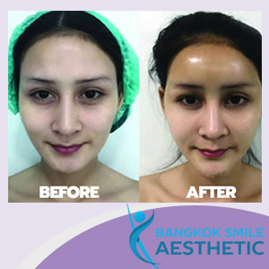 Bangkok Smile Aesthetic Clinic