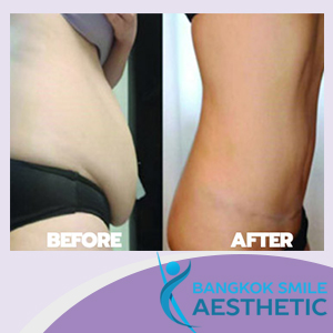 Bangkok Smile Aesthetic Clinic