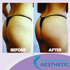 Bangkok Smile Aesthetic Clinic